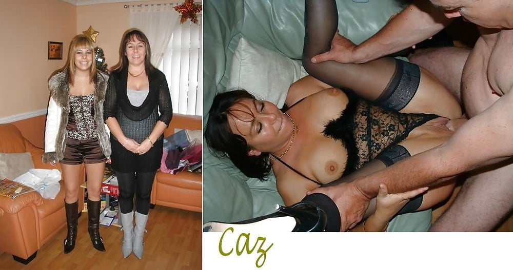 bofere and after 99 #89921254