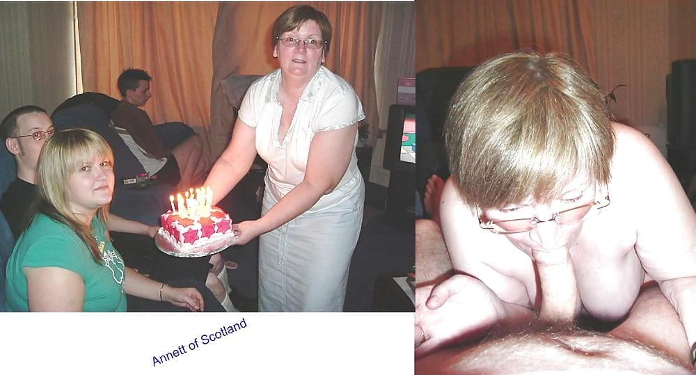 bofere and after 99 #89921260