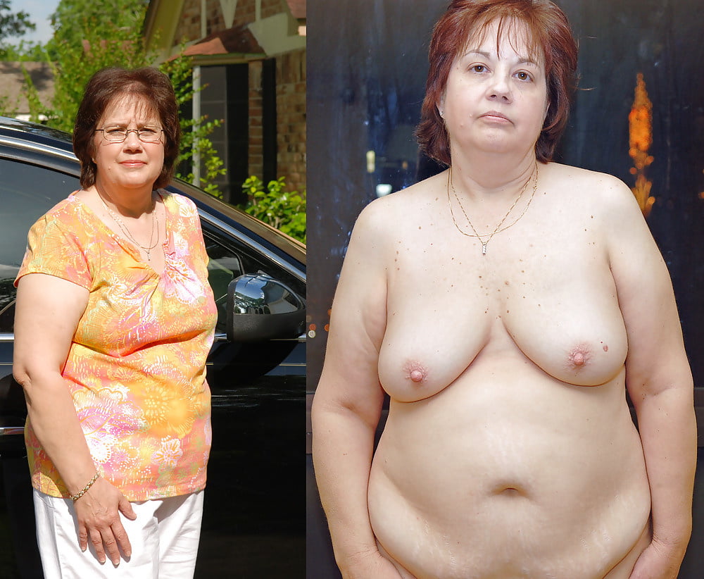 bofere and after 99 #89921275