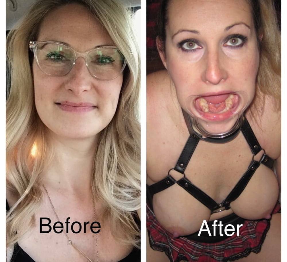 bofere and after 99 #89921300