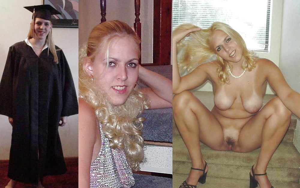 bofere and after 99 #89921306