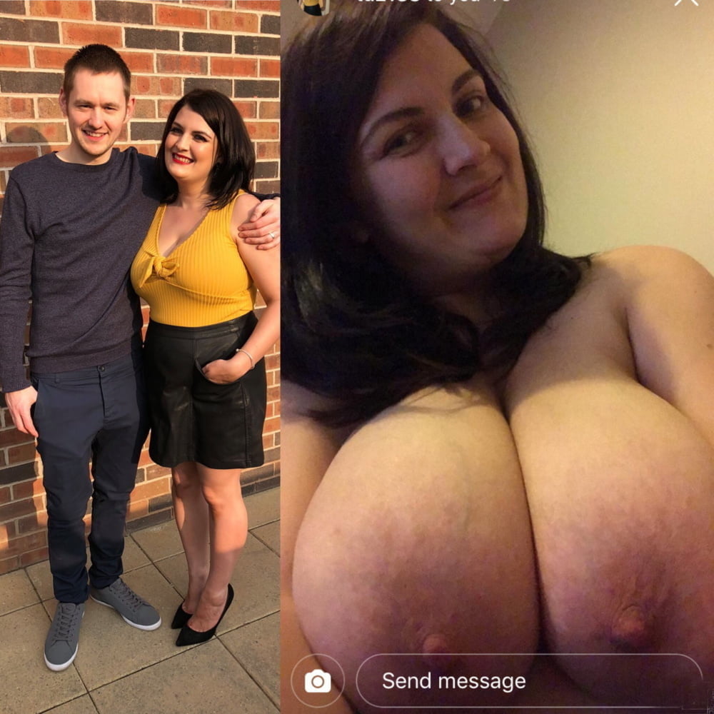 bofere and after 99 #89921310