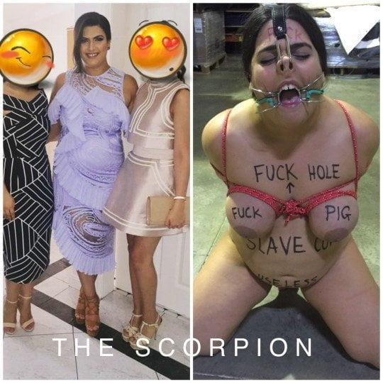 bofere and after 99 #89921334