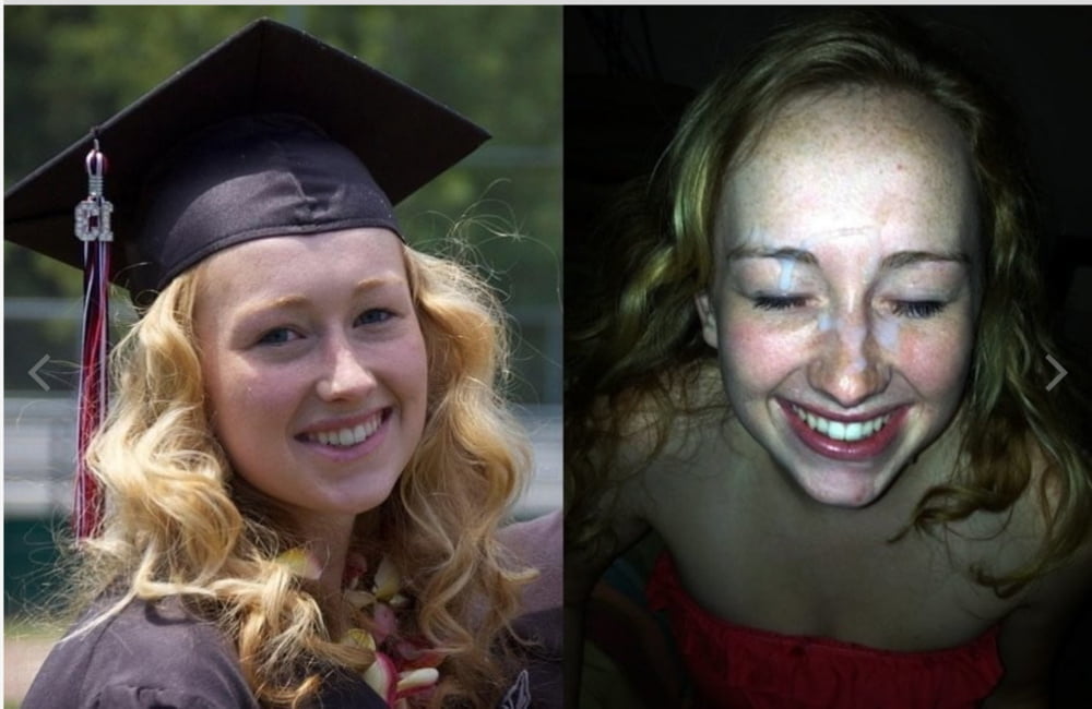 bofere and after 99 #89921373