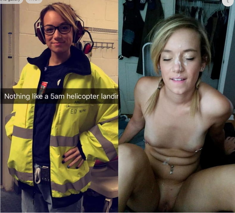 bofere and after 99 #89921376