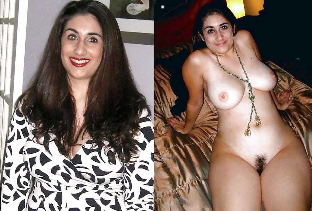 bofere and after 99 #89921382