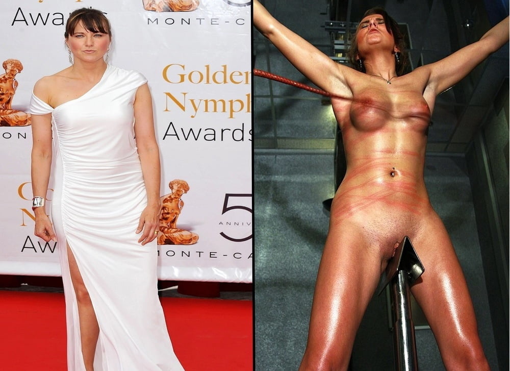 bofere and after 99 #89921391