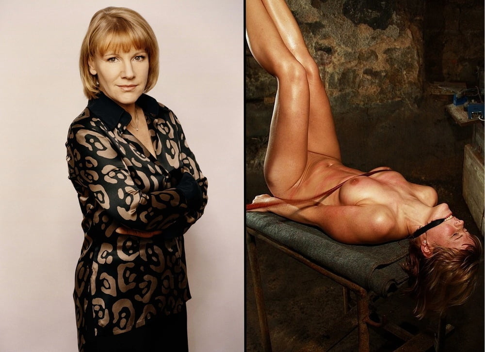 bofere and after 99 #89921394