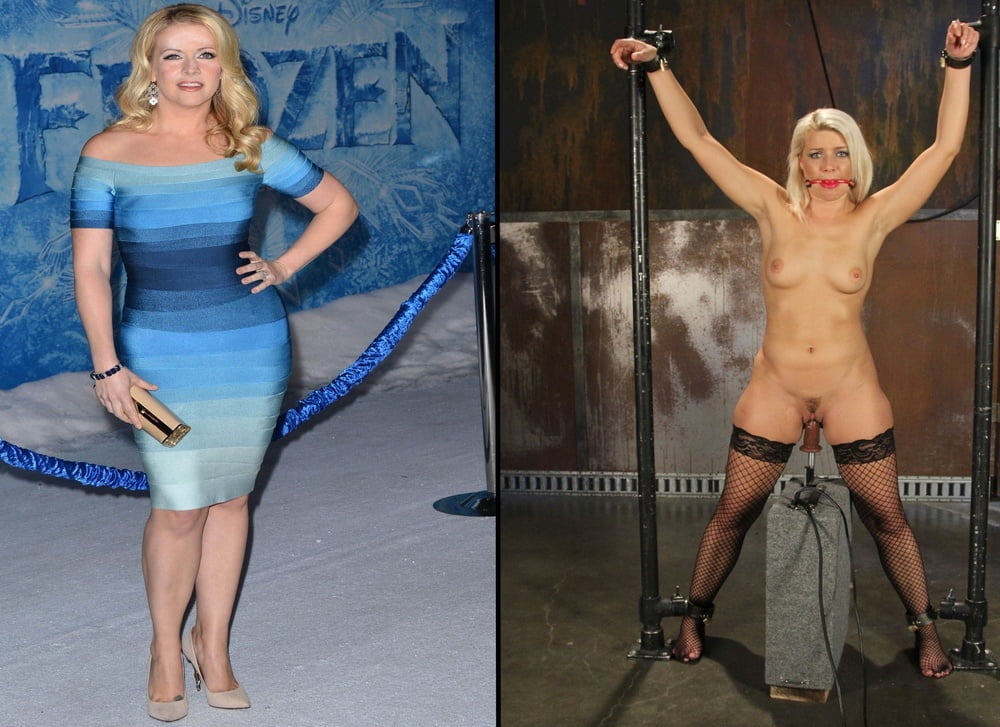 bofere and after 99 #89921401