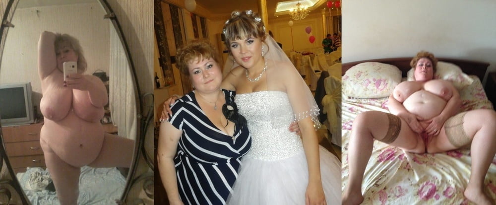 bofere and after 99 #89921476