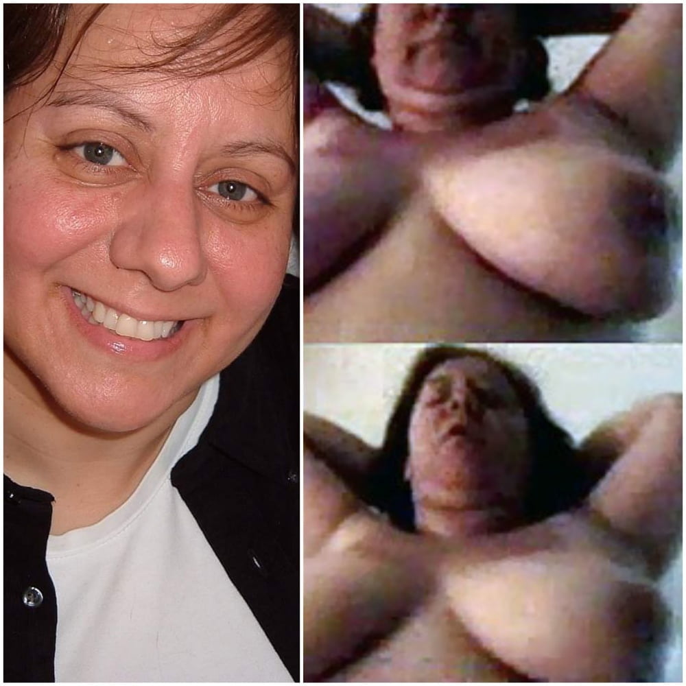 Erectione(3631) #80175999