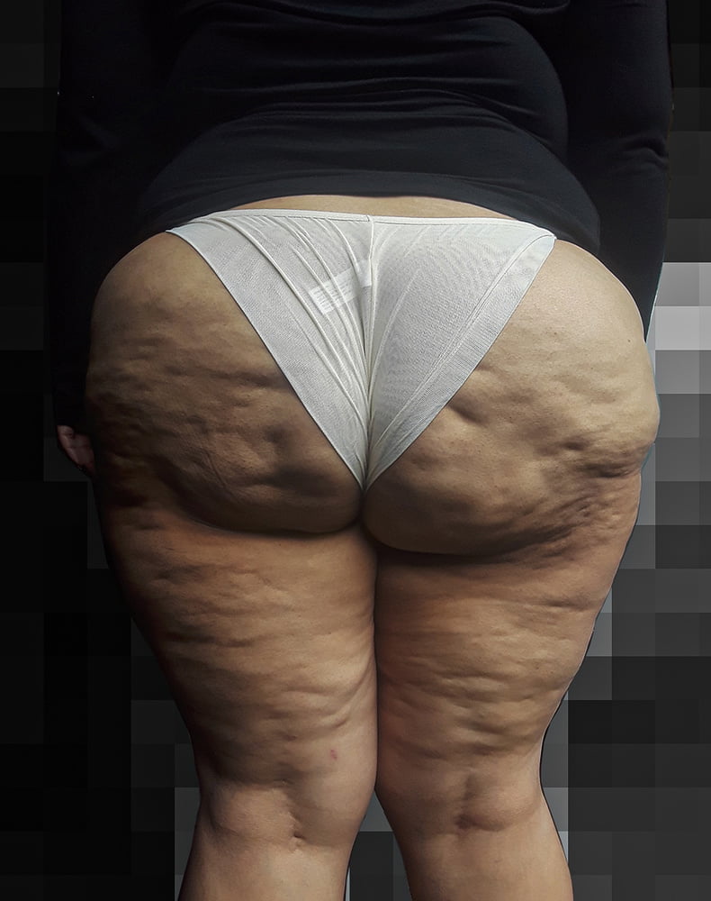 Mas de mi nalgona en calzones
 #104765040