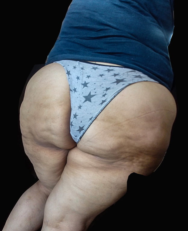 Mas de mi nalgona en calzones
 #104765148