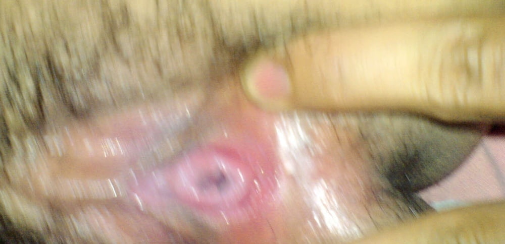 Frech frech frech
 #97274082