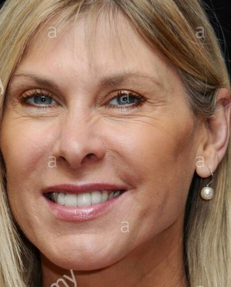 Sharron davies
 #94037743