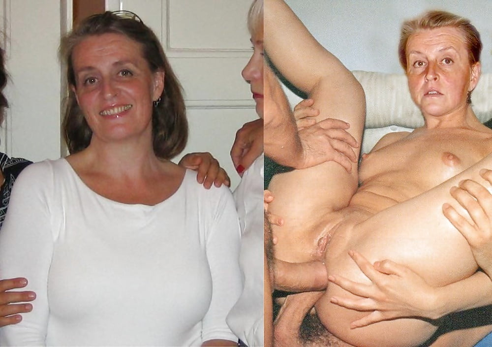 Erectione(3588) #87992816