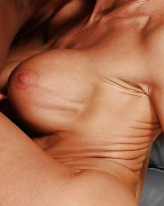 Breast Implant Fake Tits Boob ripple wrinkle #106409629