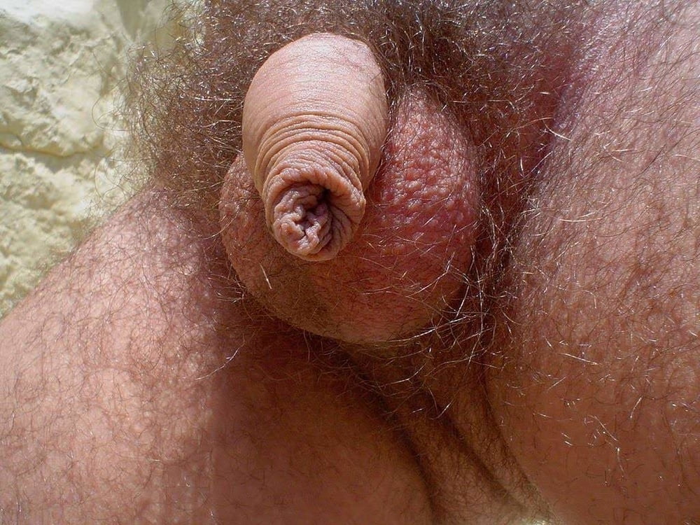 Forskin Cocks 30 #90903211
