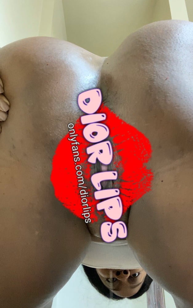 Needs Attention #106270026