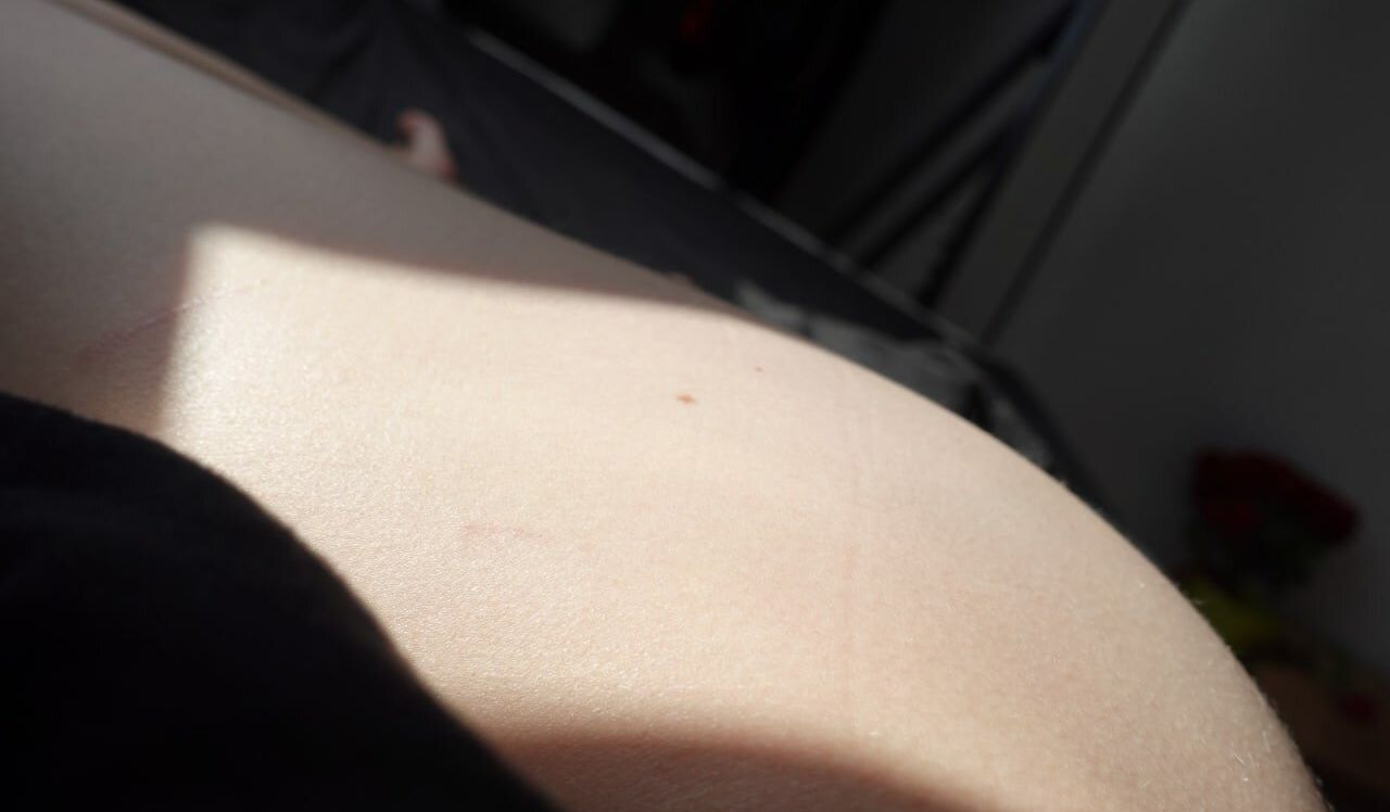 Allotrop nude #108546068