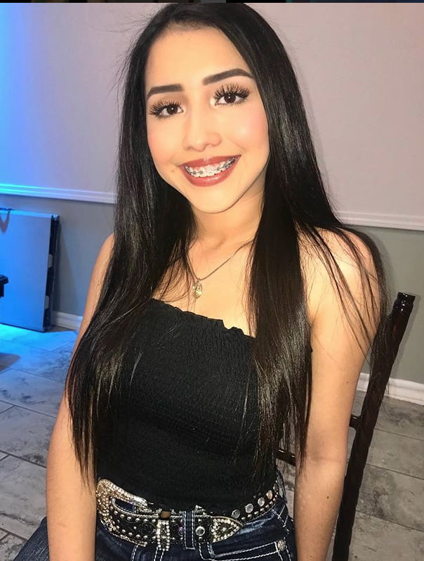 Young teen with Braces #81623477