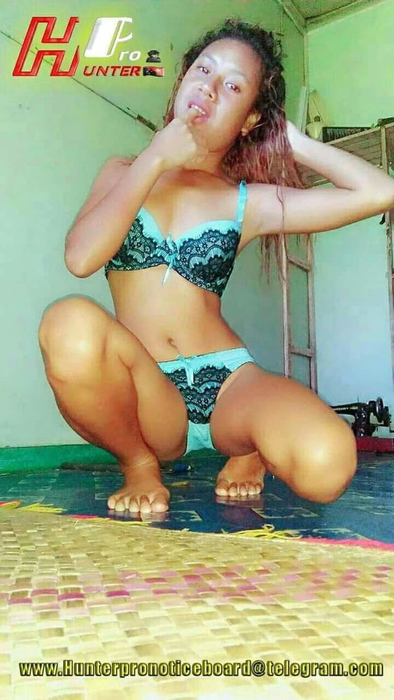 SET 8 #99264053