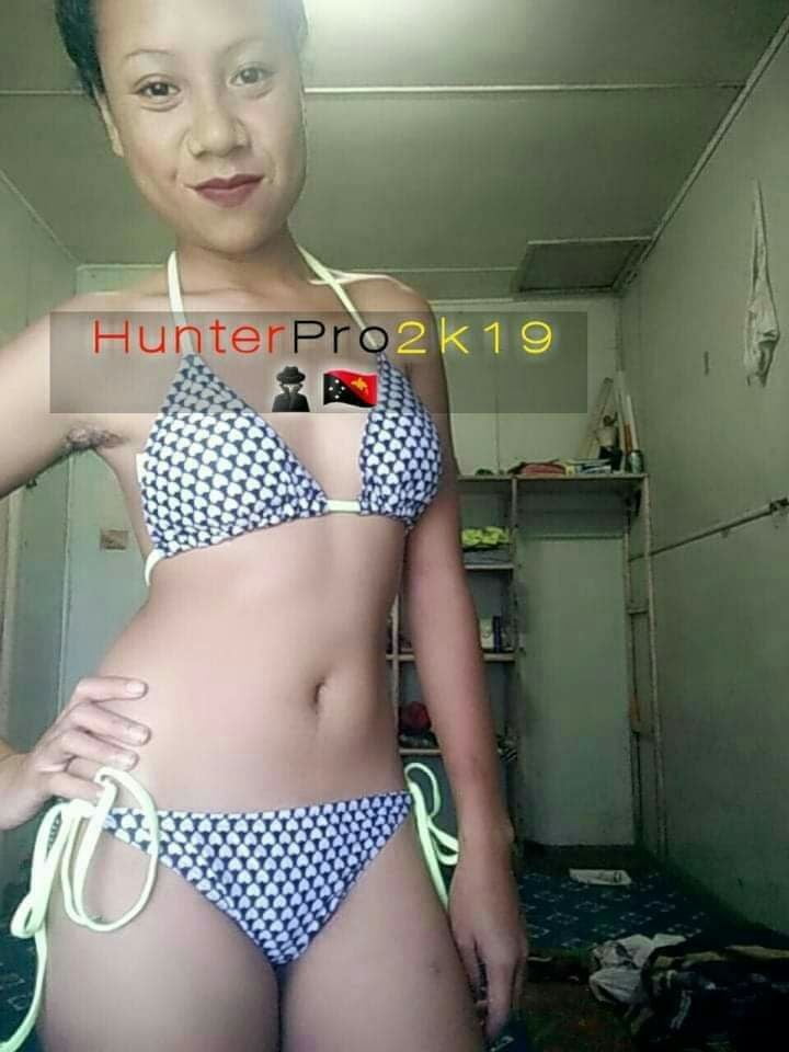 SET 8 #99264081
