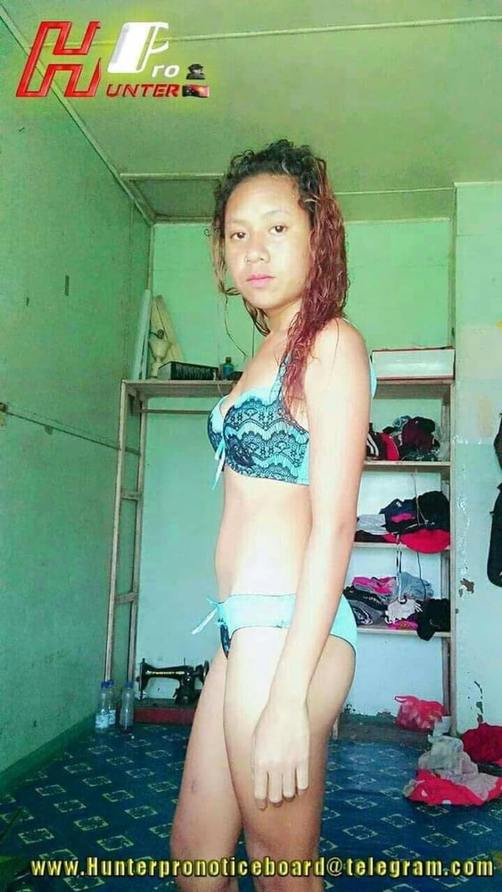 SET 8 #99264086