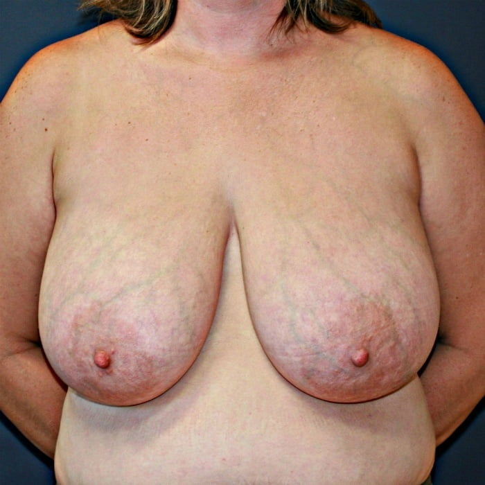 Huge mature tits
 #95797245