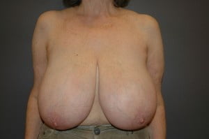Huge mature tits
 #95797251
