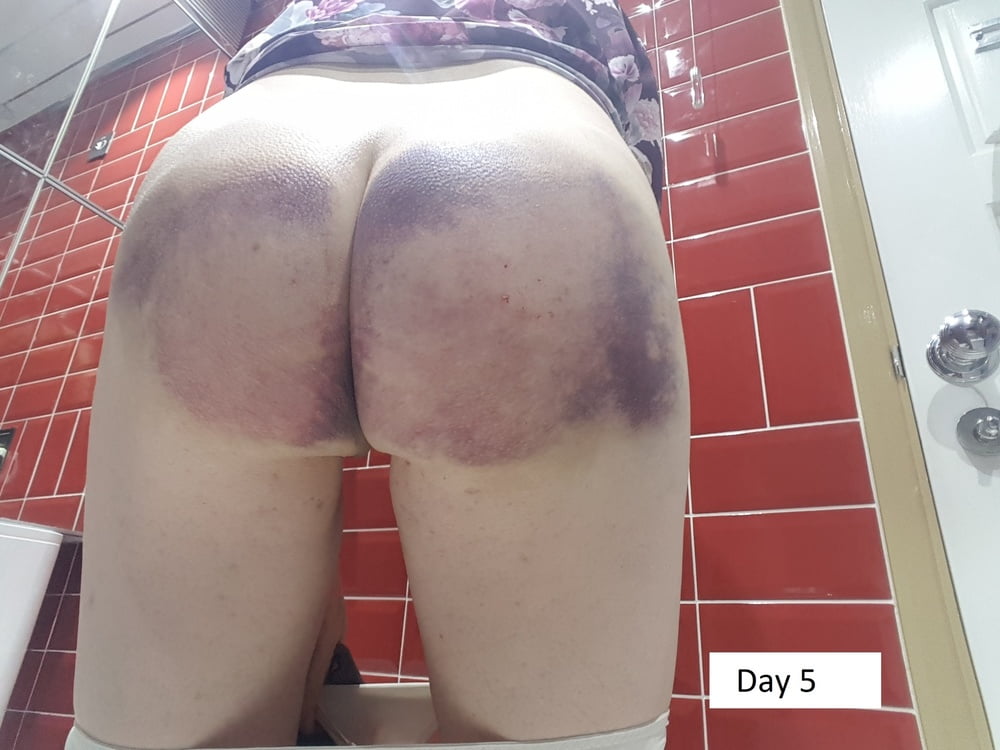 Spanking by Mistress Jenny Bruised Ass for over 7 days #106818382