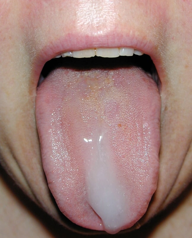 3.メリーランドのスインガー、ショーオフ
 #94818587