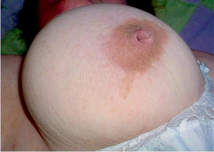 inverted nipple #102701226
