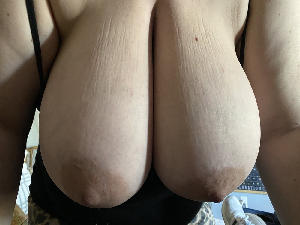 fat saggy tits #81786520