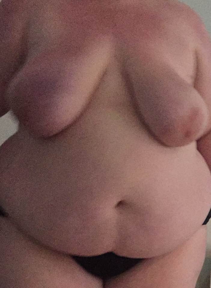Fat Piggy Bitch #99296140