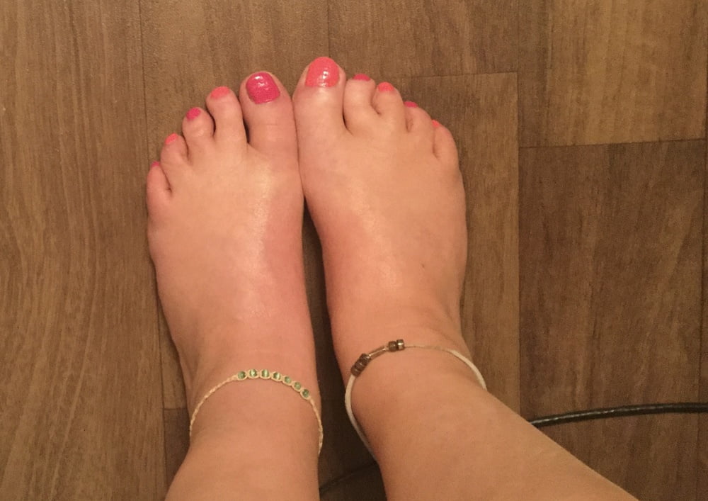 Cute toes for the summer #103783381