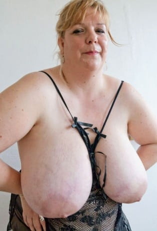 ぽっちゃり、ふっくら、おデブちゃん 2
 #82079369