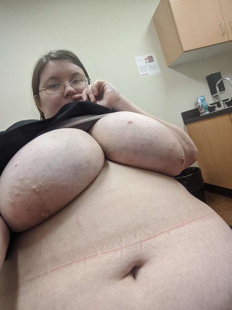 BBW Clinic Worker with huge Tits #100805306