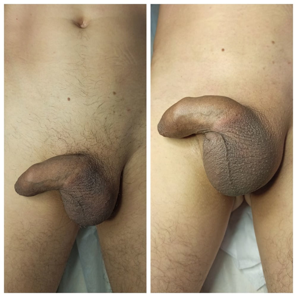 Look! After my procedure, all the dicks really got bigger! #107059179