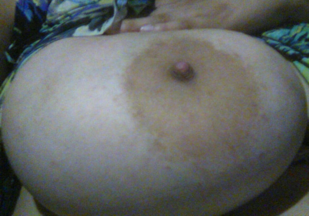 Retarded ugly Girl Huge tits #88160408