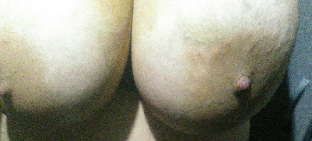 Retarded ugly Girl Huge tits #88160423