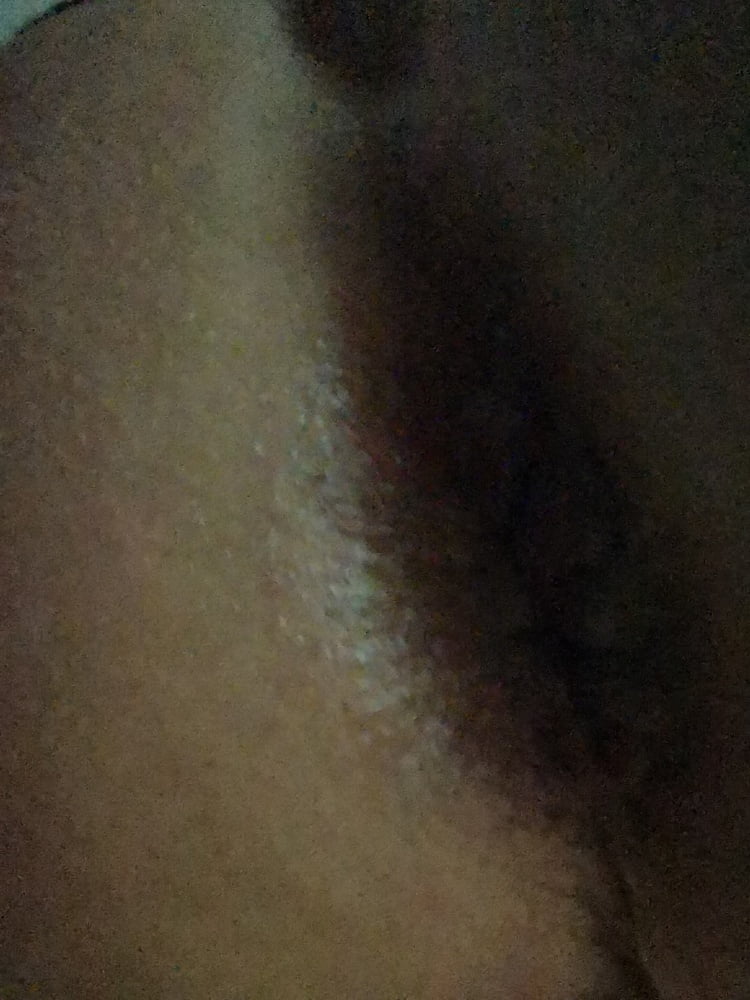 Anal #105672786