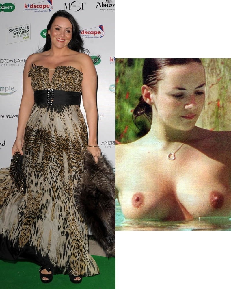 Dressed Undressed Gallery 234 16072020 #90262478