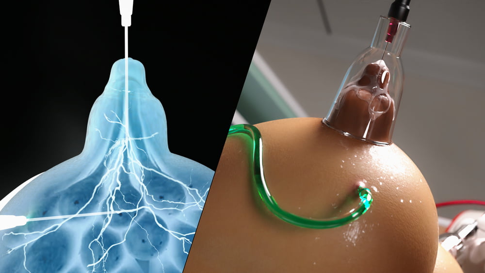 Miki3DX The Experiment Chapter #99497274