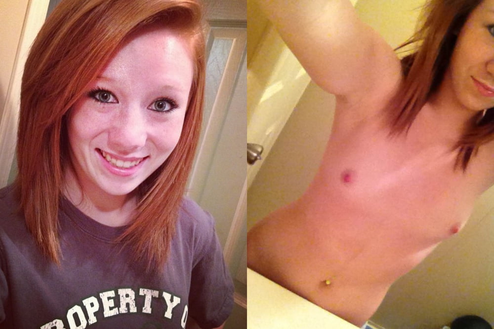Before and After 2 #80992861