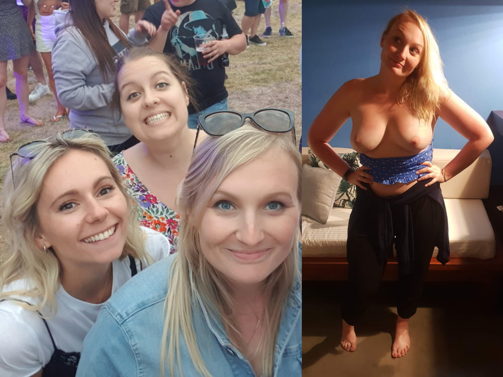 Before and After 2 #80992888