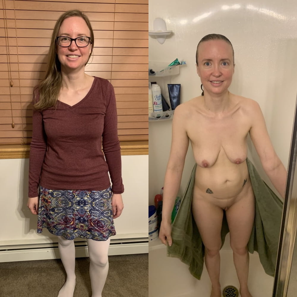Before and After 2 #80992891