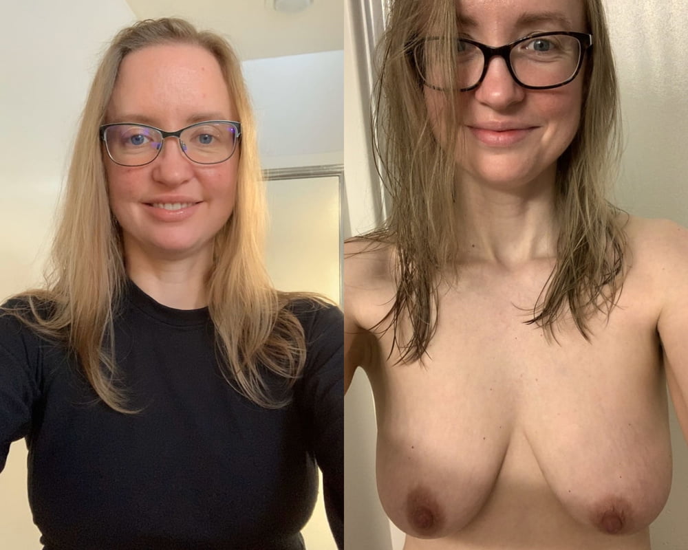 Before and After 2 #80992897