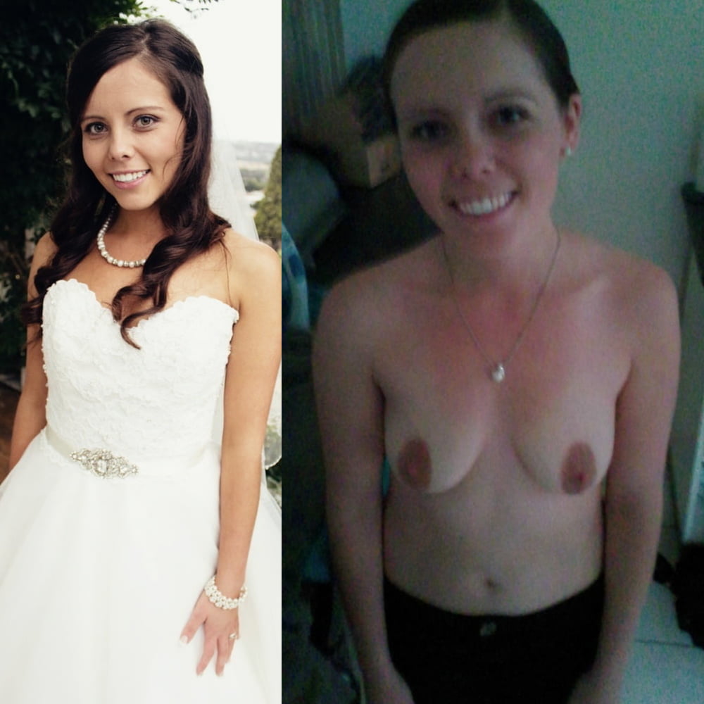 Before and After 2 #80992915