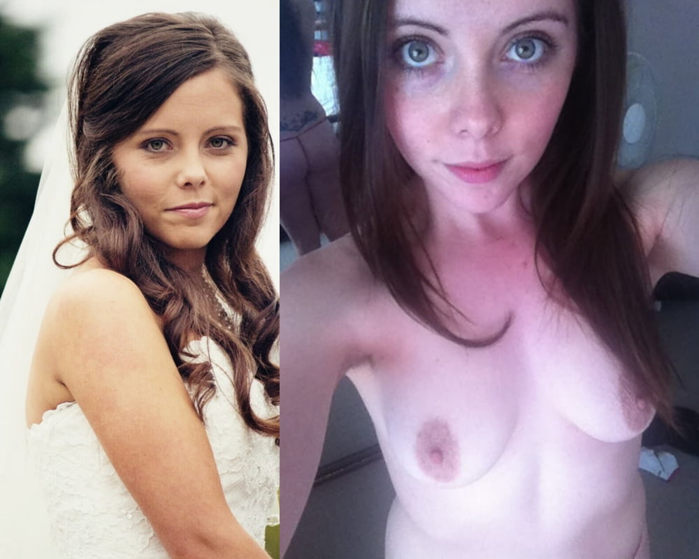 Before and After 2 #80992918